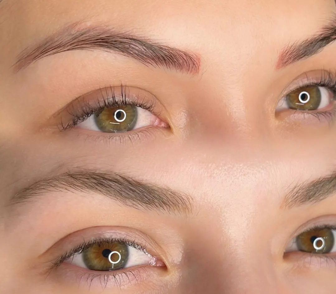 Remoción de pigmento en cejas, caso 3: comparación del pigmento anterior y la piel después del tratamiento